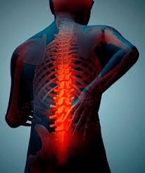 back-injuries